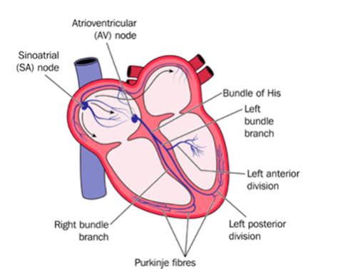 Right Anterior Bundle Branch Block