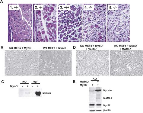 Maml1 Deficiency Results In Muscular Dystrophy And Defects In