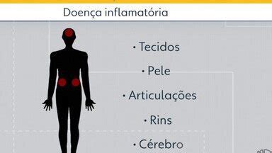 Bom dia Diario Fevereiro Roxo alerta sobre lúpus Alzheimer e