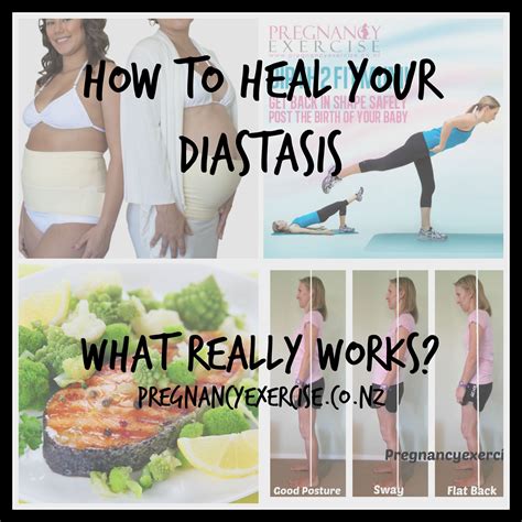 How To Heal Diastasis Recti Post Birth Healing Diastasis Recti