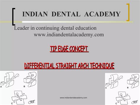 Tip Certified Fixed Orthodontic Courses By Indian Dental Academy Ppt