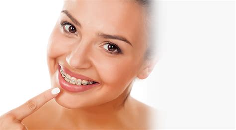 Clear Ceramic Braces Clarity Advanced™ Braces Signature Orthodontics