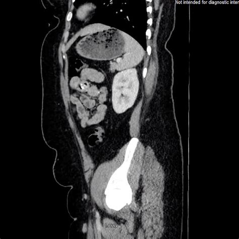 Gross Anatomy Glossary Stomach Imaging Ditki Medical Biological