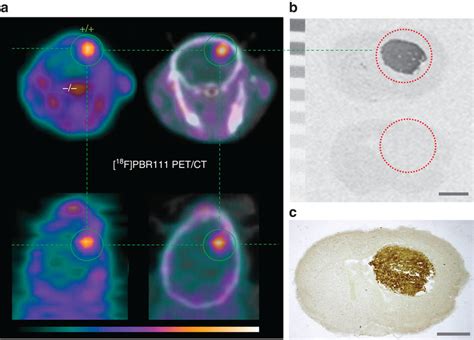 Pbr Tspo Expressing Brain Tumour In Global Tspo Mouse Brain A