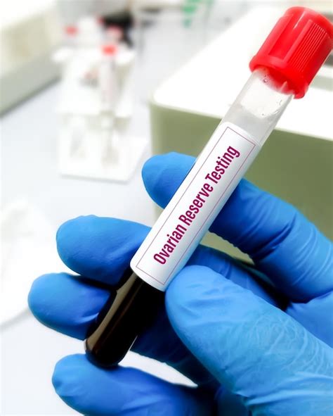 Premium Photo Blood Sample For Ovarian Reserve Test Ort Is A Test