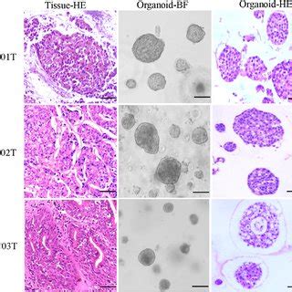 Patient Derived Bladder Cancer Organoid Cultures Expand Long Term In