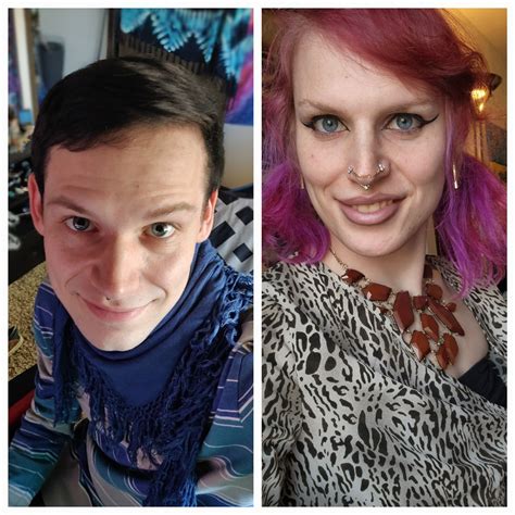 10000 Best Rtranstimelines Images On Pholder 29 2 Years Hrt Mtf 1year To 2 Years