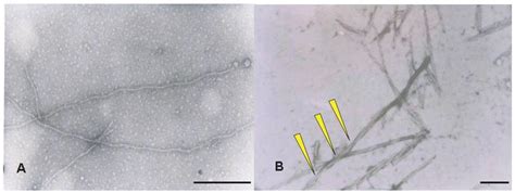 Characterization Of Ad Phf And Tau Filaments By Tem Filaments Obtained