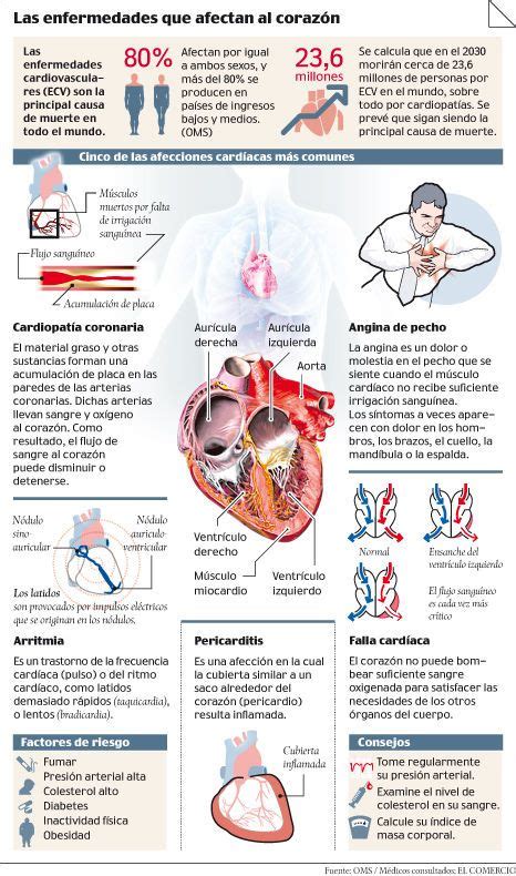 Las Enfermedades Que Afectan Al Corazón Patologias Cardiovasculares