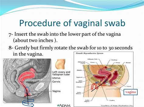 High Vaginal Swab Procedure Anne Grant