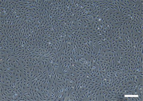 morphology  characterization  bmscs npcs  bmsc exos