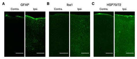 Figures And Data In Two Photon Calcium Imaging Of The Medial Prefrontal