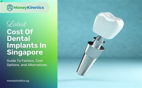 Cost Of Dental Implants In Singapore 2022 Factors And Options