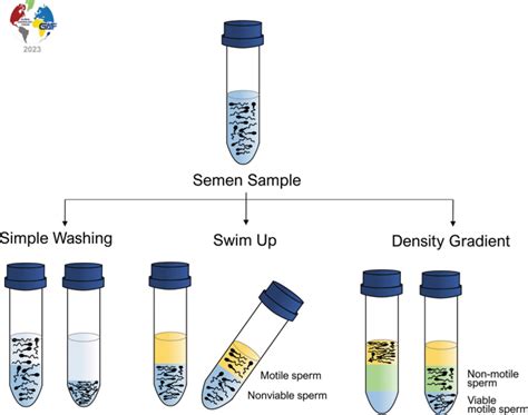 Sperm Preparation And Sperm Selection Techniques Springerlink