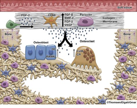 Figure From Guided Bone Regeneration Materials And Biological