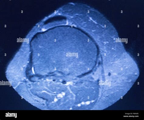 Mrt Magnet Resonanz Tomographie Medizinischen Test Scanergebnisse Mit