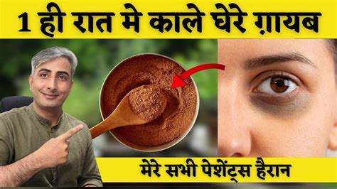 1 ही रात मे आंखों के काले घेरे हटाने के घरेलू नुस्खे Dark Circles Kaise