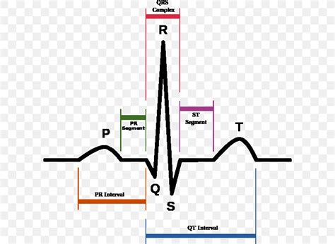 Qt Interval Long Qt Syndrome Pr Interval Qrs Complex