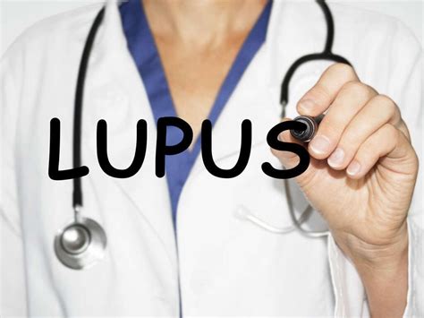 Lupus Rashes: All About Lupus Rashes