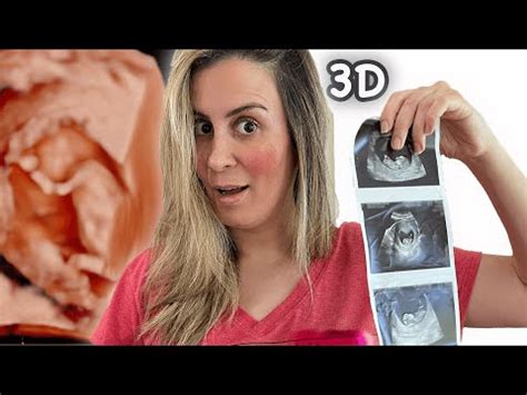 Week 10 14 Pregnancy Update 3D Baby Ultrasound Vlog YouTube