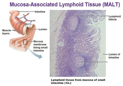 mucosa associated lymphoid tissue, malt, intestine, lymphoid follicle ...