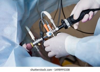 Process Urological Surgery Operation Using Laparoscopic Stock Photo