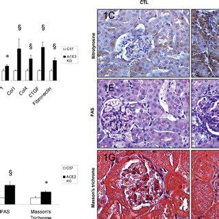 A Western Blotting Analysis Of Ace Protein Expression In Renal Tissue