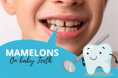 Mamelons On baby Teeth: What Are These & How To Treat Them