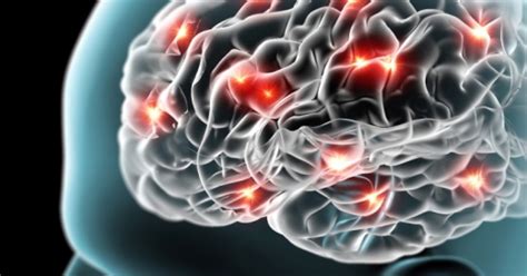 Faculdade De Neurociencia No Brasil