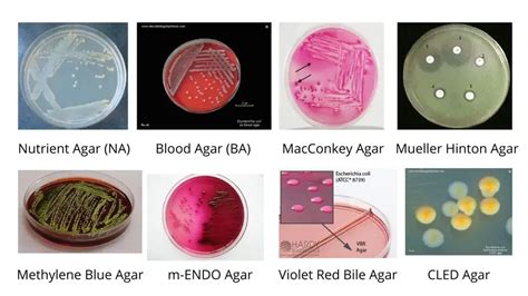 Escherichia Coli E Coli Morphology Arrangement Cultural