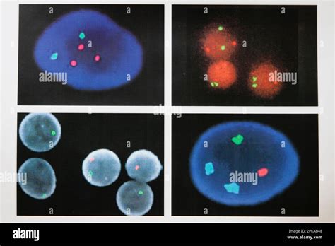 Cytogenetics Laboratory Prenatal Diagnosis By Medical Imaging Fish