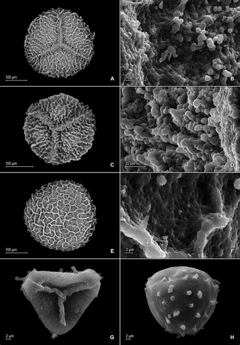 Scanning Electron Micrographs Of Mega And Microspores Of S