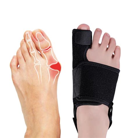 Bunion Corrector For Men Women Hallux Valgus Straightener Adjustable