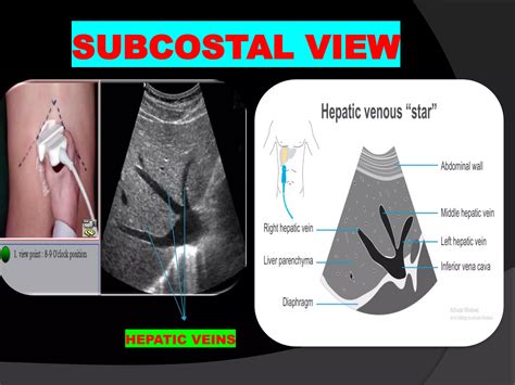 How To Do Liver Ultrasound Pdf
