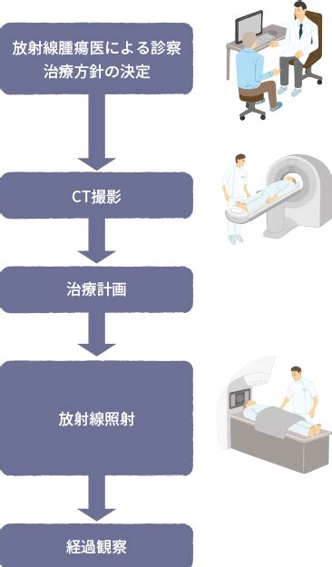 肺がんの放射線療法の特徴と治療後の副作用・リスク｜おしえて 肺がんのコト【中外製薬】