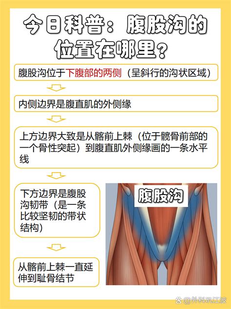 今日科普：腹股沟的位置在哪里？