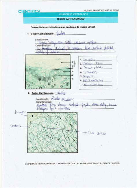 Solution Ucsur Cuaderno De Trabajo Histologia De Tejido Cartilaginoso