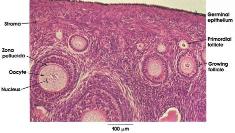 Plate Ovary