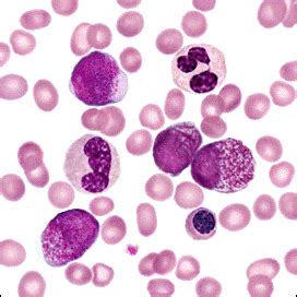 Solved Hematology Question What Morphologies Rbc Wbc Chegg