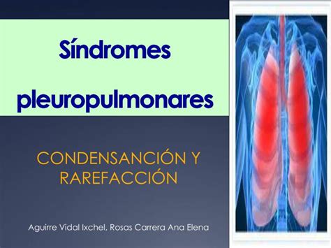 PPT Síndromes pleuropulmonares PowerPoint Presentation free download