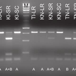 Bamhi Digestion Of Nodc Gene Of Selected Rhizobium Leguminosarum