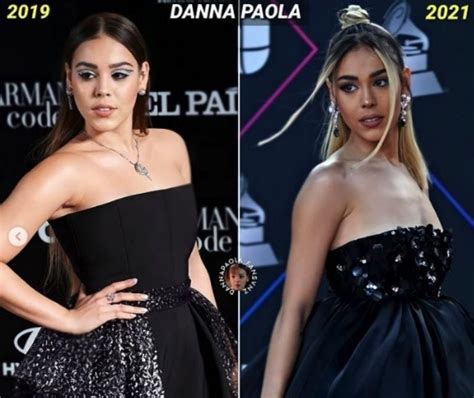 Danna Paola Nariz Antes Y Despues