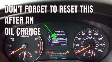 Kia Check Engine Light Reset