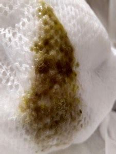Les selles du bébé allaité