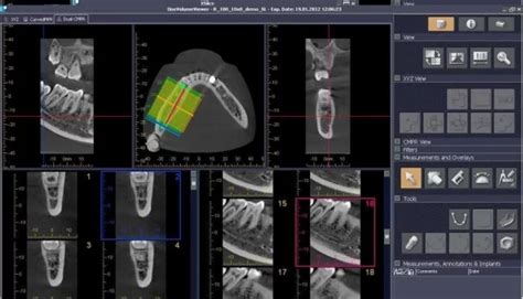 Morita Veraviewepocs D R Panoramik R Ntgen Volumetrik Tomografi