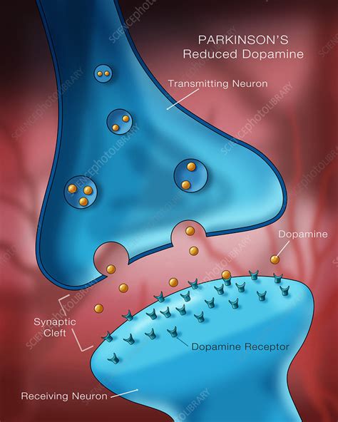 Dopamine in Parkinson's, Illustration - Stock Image - C027/7565 ...