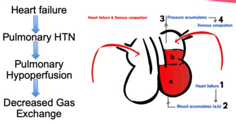 PATHO M8 ALTERED PULMONARY FUNCTION Flashcards Quizlet