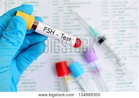 Test Tube Blood Sample Follicle Image & Photo | Bigstock