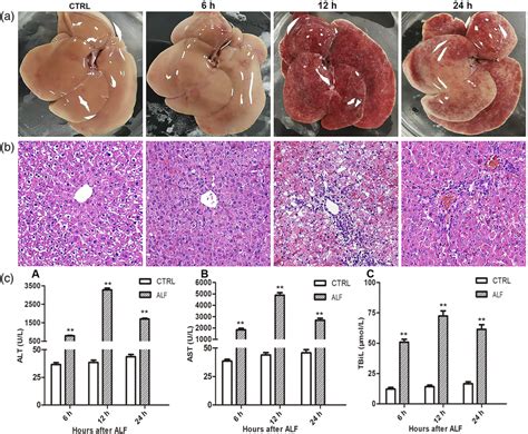 Effect Of Lipopolysaccharide Lpsd Galactosamine D Gal Treatment On Download Scientific