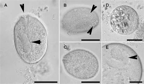 Trophozoites Of Balantidium Coli In Formalin Preserved Feces Of A